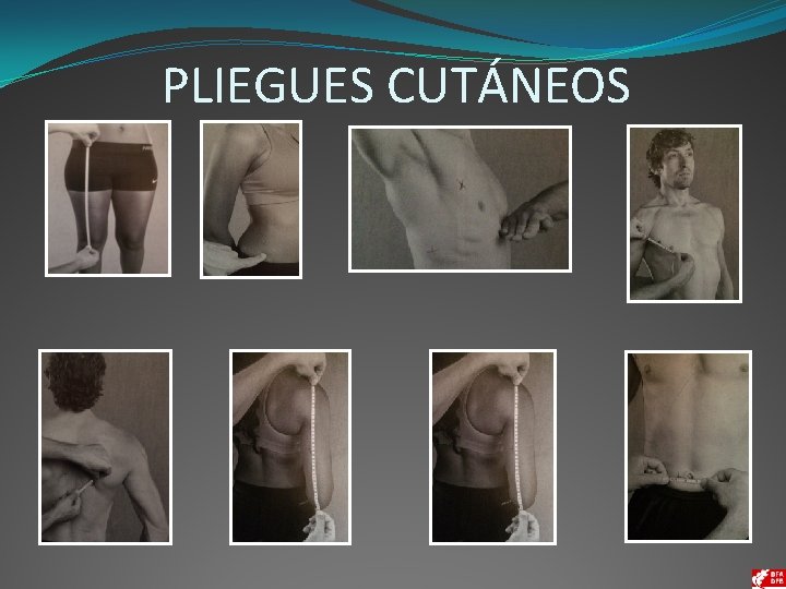 PLIEGUES CUTÁNEOS 