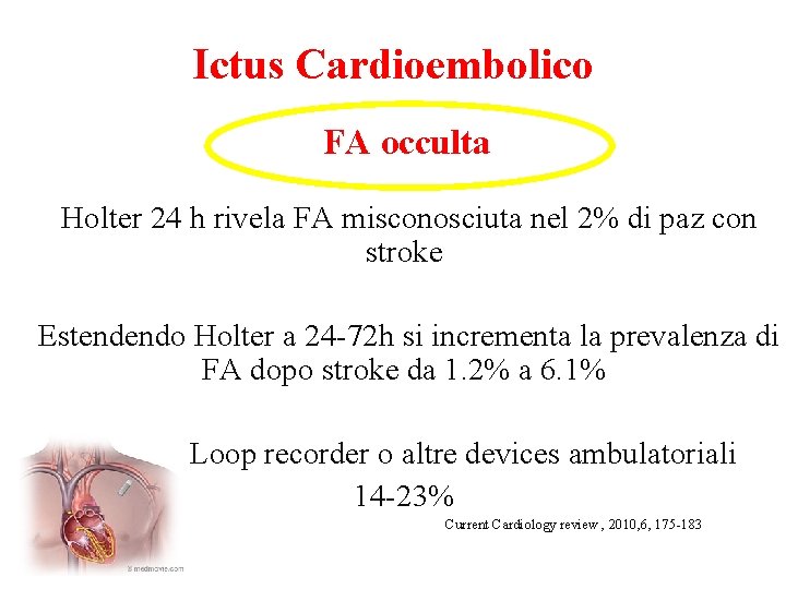 Ictus Cardioembolico FA occulta -Holter 24 h rivela FA misconosciuta nel 2% di paz