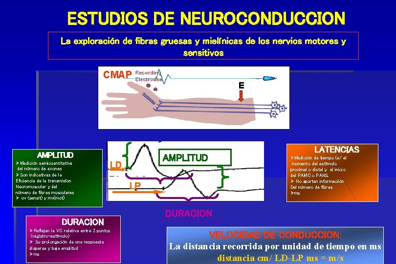 ESTUDIOS DE NEUROCONDUCCION La exploración de fibras gruesas y mielínicas de los nervios motores