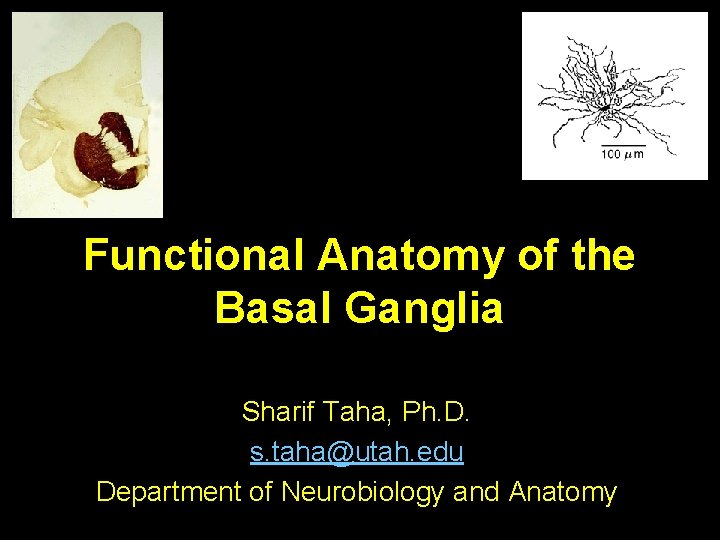 Functional Anatomy of the Basal Ganglia Sharif Taha