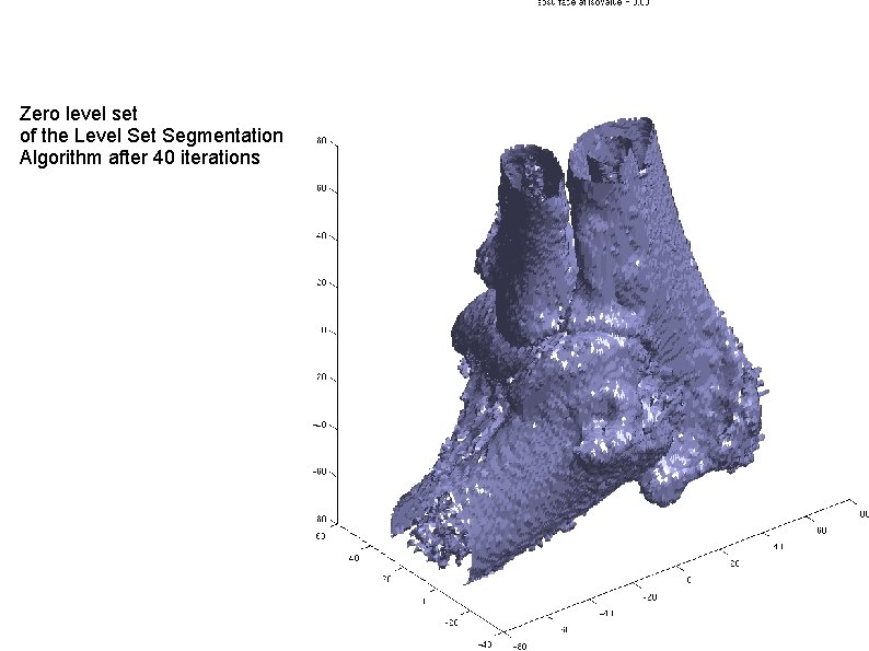 Zero level set of the Level Set Segmentation Algorithm after 40 iterations 