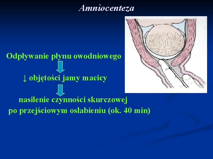 Amniocenteza Odpływanie płynu owodniowego ↓ objętości jamy macicy nasilenie czynności skurczowej po przejściowym osłabieniu