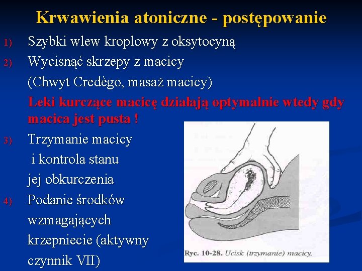 Krwawienia atoniczne - postępowanie 1) 2) 3) 4) Szybki wlew kroplowy z oksytocyną Wycisnąć