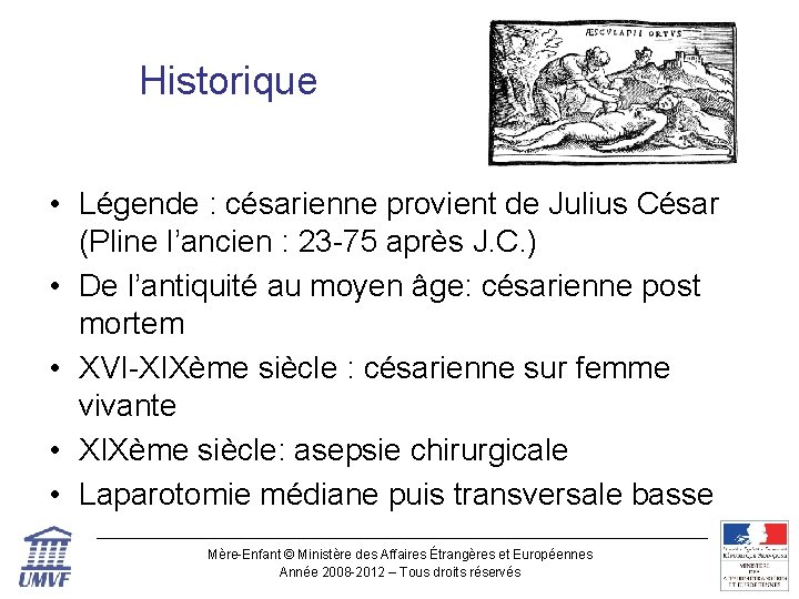 Historique • Légende : césarienne provient de Julius César (Pline l’ancien : 23 -75