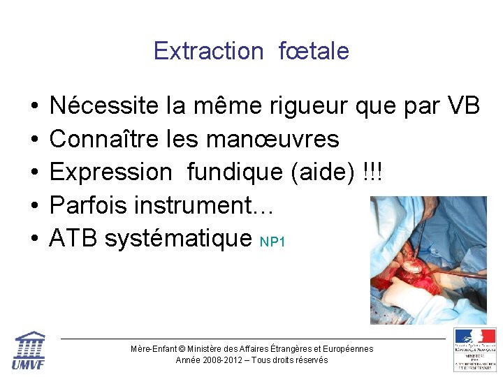 Extraction fœtale • • • Nécessite la même rigueur que par VB Connaître les