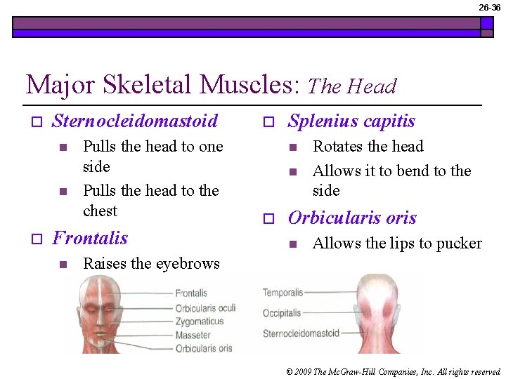 26 -36 Major Skeletal Muscles: The Head o Sternocleidomastoid n n o Pulls the