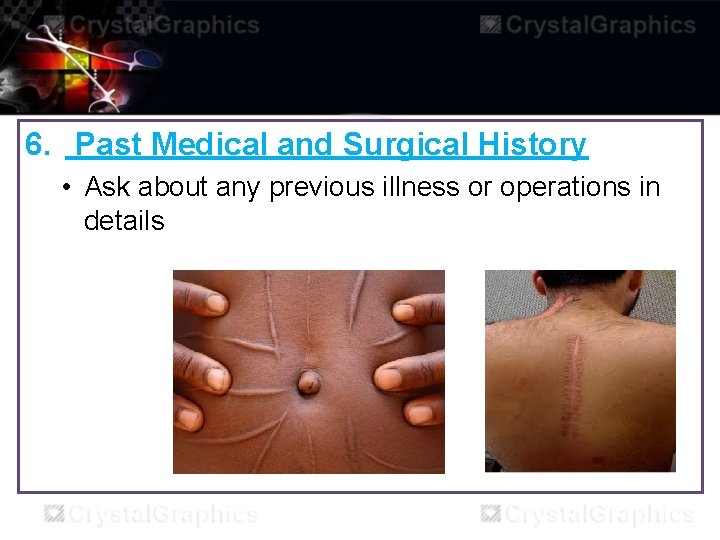 6. Past Medical and Surgical History • Ask about any previous illness or operations