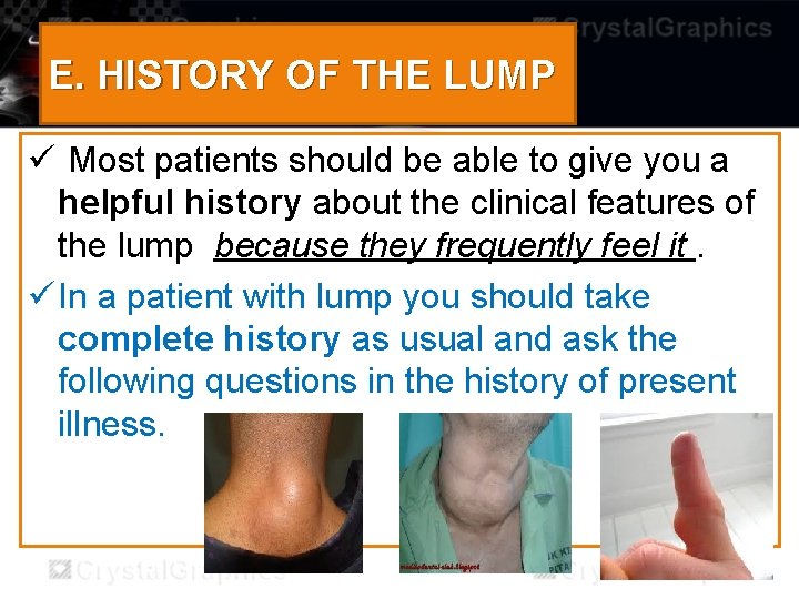 E. HISTORY OF THE LUMP ü Most patients should be able to give you