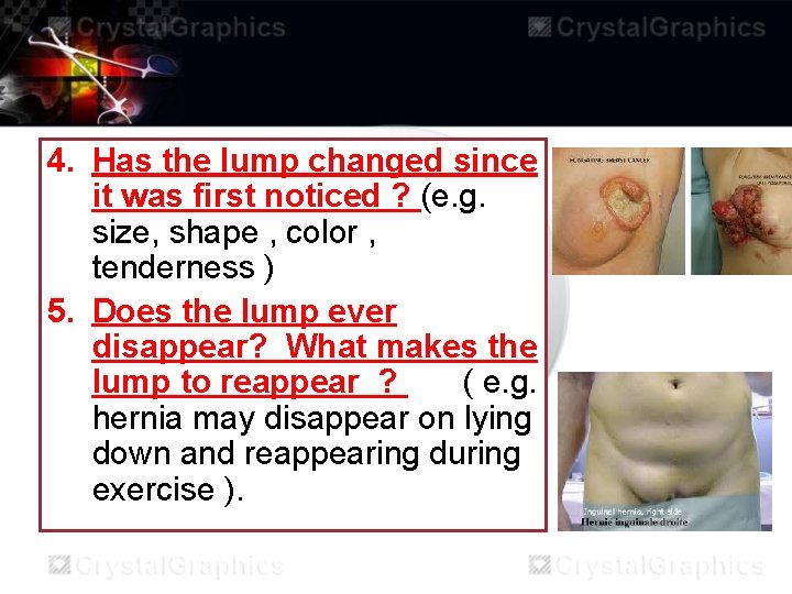 4. Has the lump changed since it was first noticed ? (e. g. size,