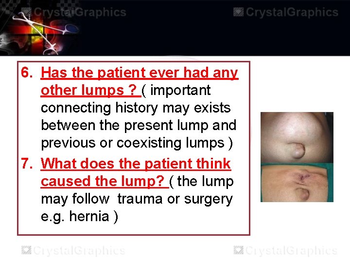 6. Has the patient ever had any other lumps ? ( important connecting history