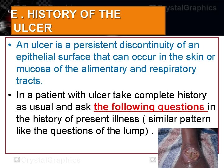 E. HISTORY OF THE ULCER • An ulcer is a persistent discontinuity of an