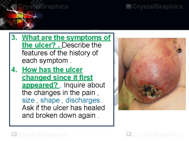 3. What are the symptoms of the ulcer? . Describe the features of the