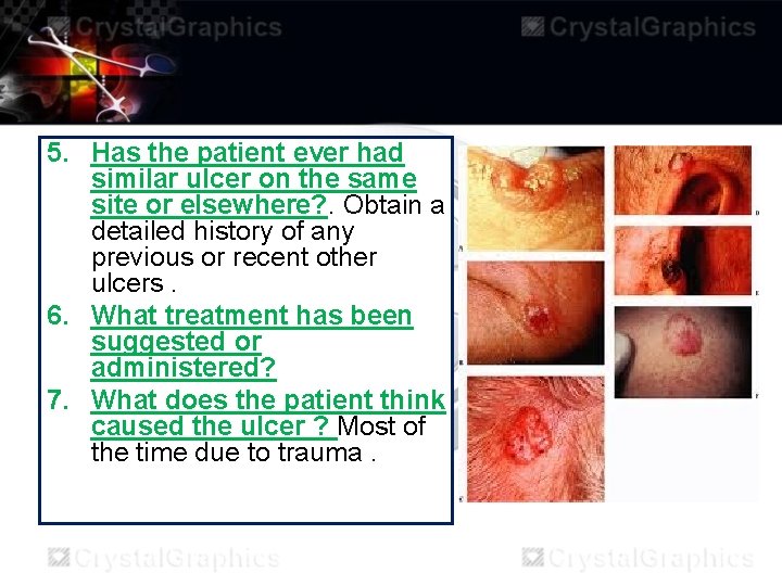 5. Has the patient ever had similar ulcer on the same site or elsewhere?