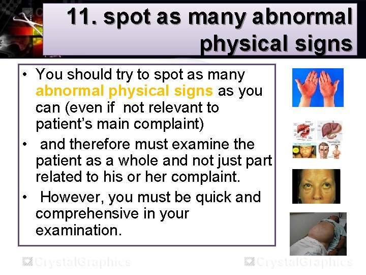 11. spot as many abnormal physical signs • You should try to spot as