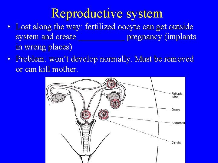 Reproductive system • Lost along the way: fertilized oocyte can get outside system and