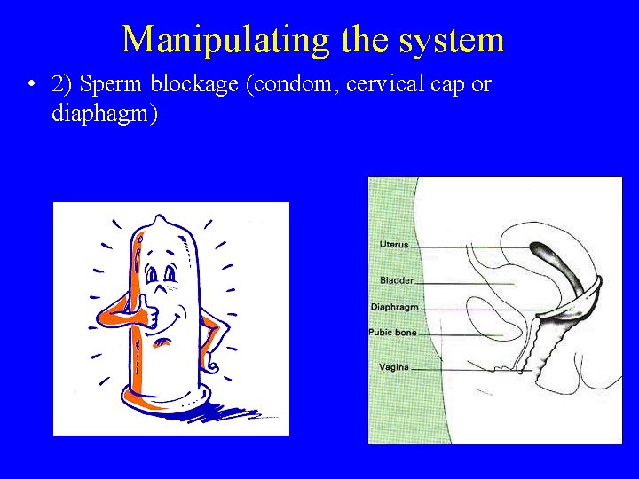 Manipulating the system • 2) Sperm blockage (condom, cervical cap or diaphagm) 