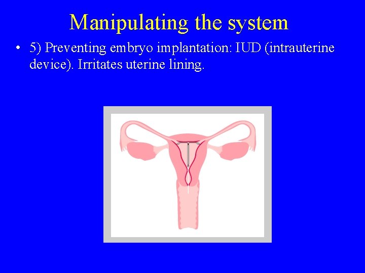 Manipulating the system • 5) Preventing embryo implantation: IUD (intrauterine device). Irritates uterine lining.