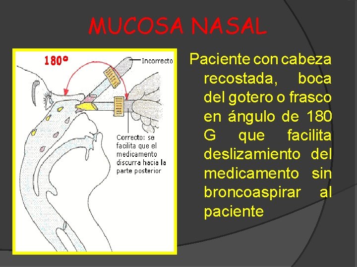MUCOSA NASAL Paciente con cabeza recostada, boca del gotero o frasco en ángulo de
