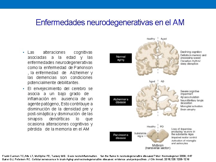 Enfermedades neurodegenerativas en el AM • Las alteraciones cognitivas asociadas a la edad y
