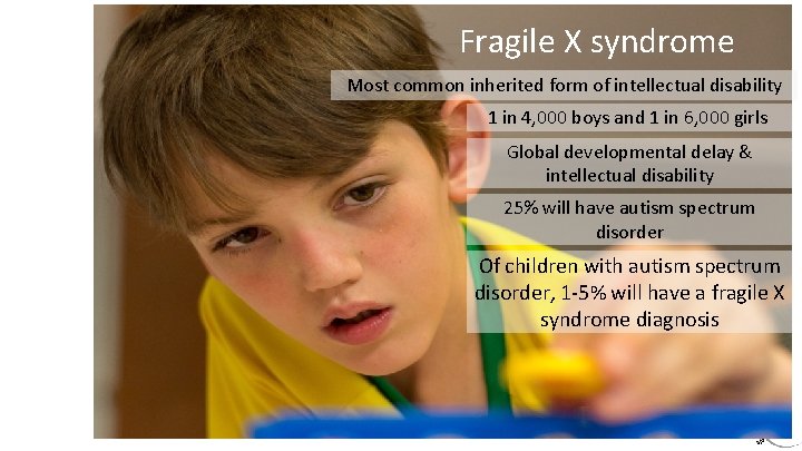Fragile X syndrome Most common inherited form of intellectual disability 1 in 4, 000