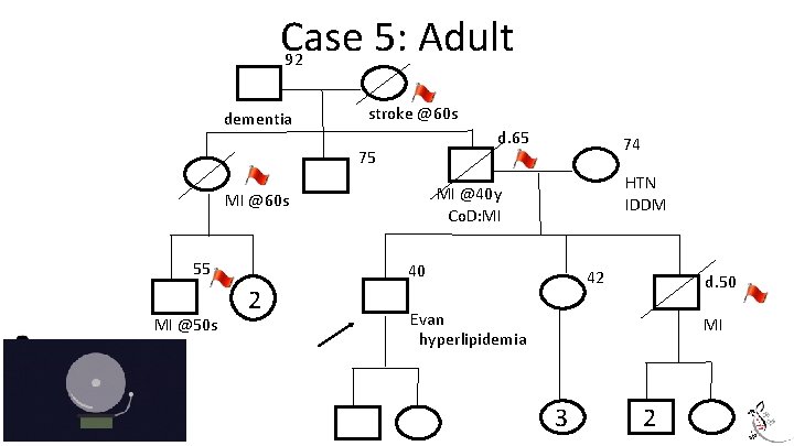 Case 5: Adult 92 dementia stroke @60 s d. 65 75 MI @50 s