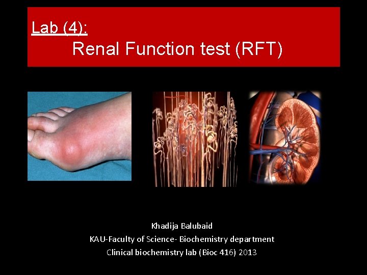 Lab (4): Renal Function test (RFT) Khadija Balubaid KAU-Faculty of Science- Biochemistry department Clinical