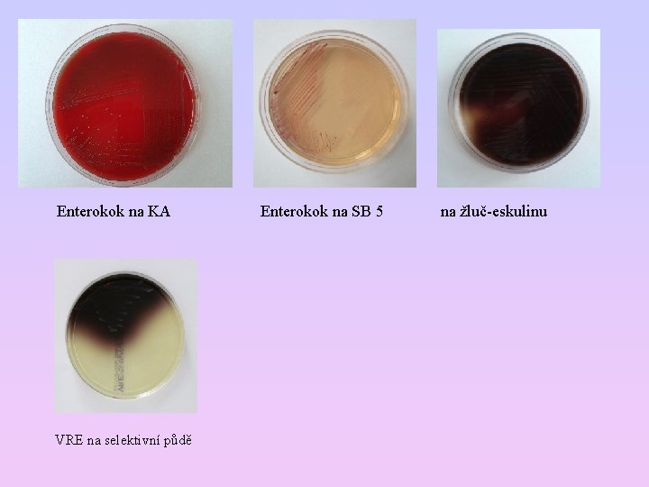  Enterokok na KA Enterokok na SB 5 na žluč-eskulinu VRE na selektivní půdě