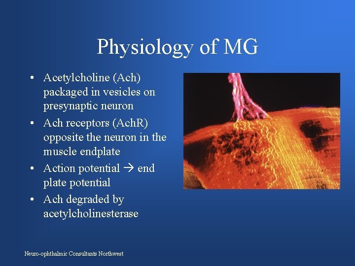 Physiology of MG • Acetylcholine (Ach) packaged in vesicles on presynaptic neuron • Ach