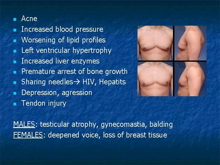n n n n n Acne Increased blood pressure Worsening of lipid profiles Left