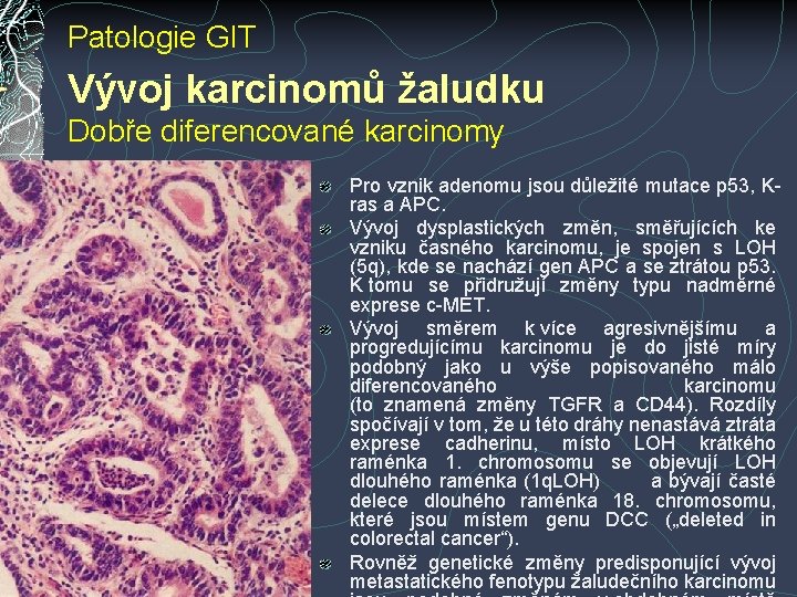 Patologie GIT Vývoj karcinomů žaludku Dobře diferencované karcinomy Pro vznik adenomu jsou důležité mutace Patologie GIT Vývoj karcinomů žaludku Dobře diferencované karcinomy Pro vznik adenomu jsou důležité mutace