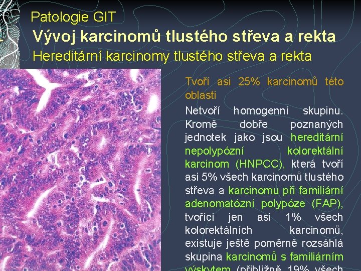 Patologie GIT Vývoj karcinomů tlustého střeva a rekta Hereditární karcinomy tlustého střeva a rekta Patologie GIT Vývoj karcinomů tlustého střeva a rekta Hereditární karcinomy tlustého střeva a rekta