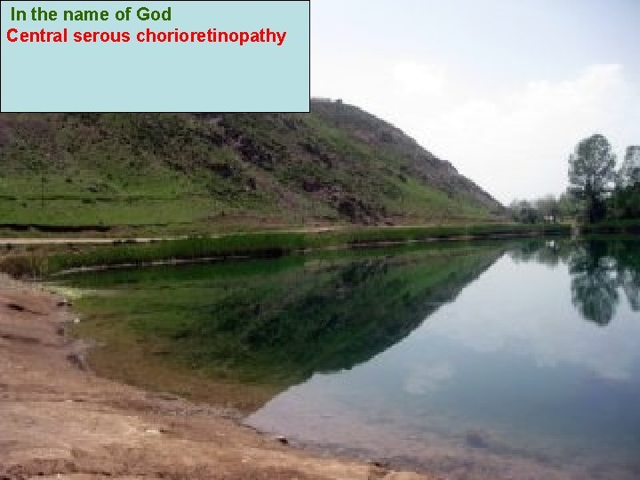 In the name of God Central serous chorioretinopathy In the name of God Central serous chorioretinopathy