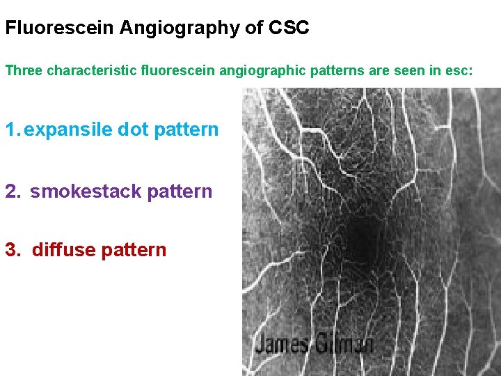Fluorescein Angiography of CSC Three characteristic fluorescein angiographic patterns are seen in esc: 1. Fluorescein Angiography of CSC Three characteristic fluorescein angiographic patterns are seen in esc: 1.