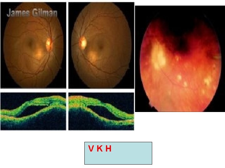 V K H V K H