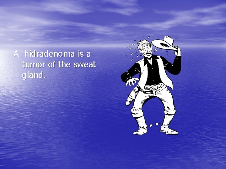 A hidradenoma is a tumor of the sweat gland. A hidradenoma is a tumor of the sweat gland.