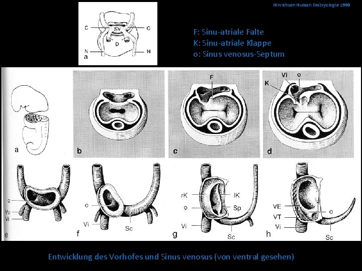 Hinrichsen Human Embryologie 1990 F: Sinu-atriale Falte K: Sinu-atriale Klappe o: Sinus venosus-Septum Entwicklung