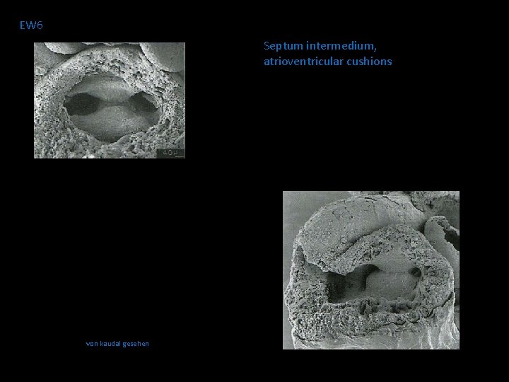 EW 6 Septum intermedium, atrioventricular cushions von kaudal gesehen 