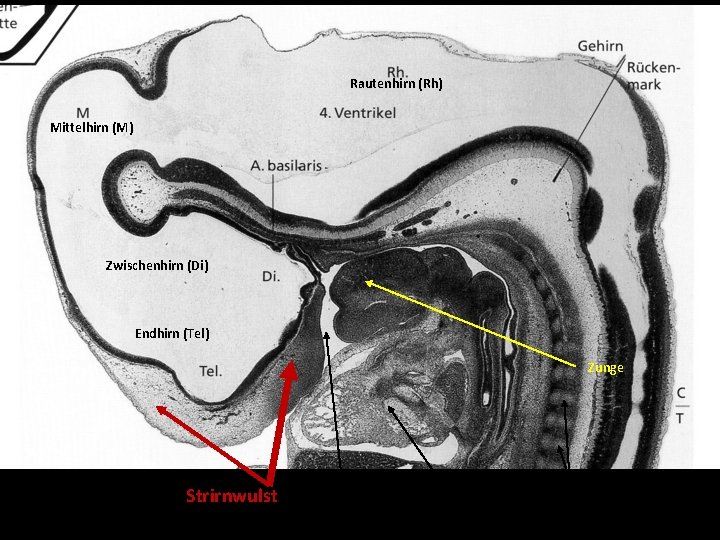 Rautenhirn (Rh) Mittelhirn (M) Zwischenhirn (Di) Endhirn (Tel) Zunge Strirnwulst Mundhöhle Herz Somiten 