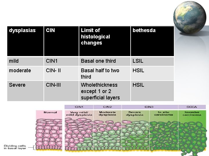 dysplasias CIN Limit of histological changes bethesda mild CIN 1 Basal one third LSIL