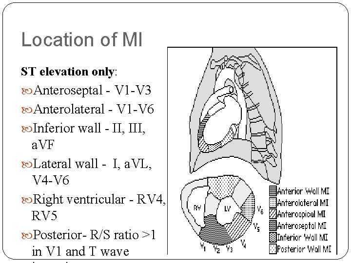 Location of MI ST elevation only: Anteroseptal - V 1 -V 3 Anterolateral -