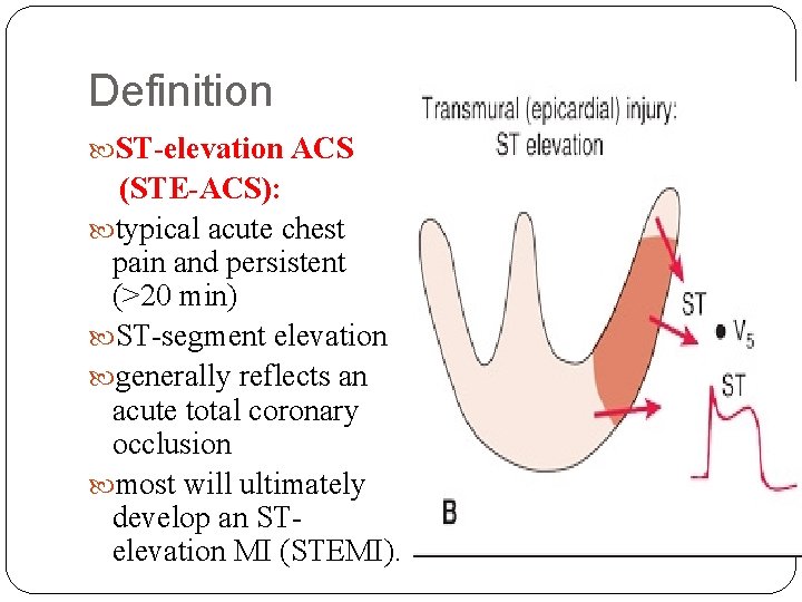 Definition ST-elevation ACS (STE-ACS): typical acute chest pain and persistent (>20 min) ST-segment elevation