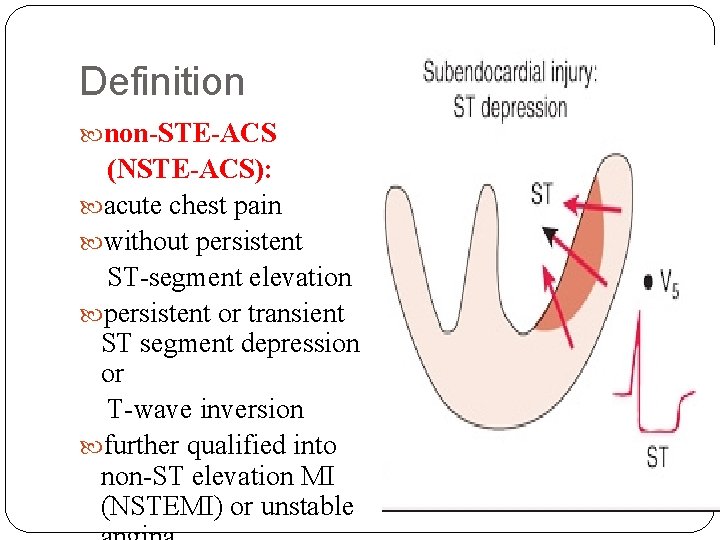 Definition non-STE-ACS (NSTE-ACS): acute chest pain without persistent ST-segment elevation persistent or transient ST