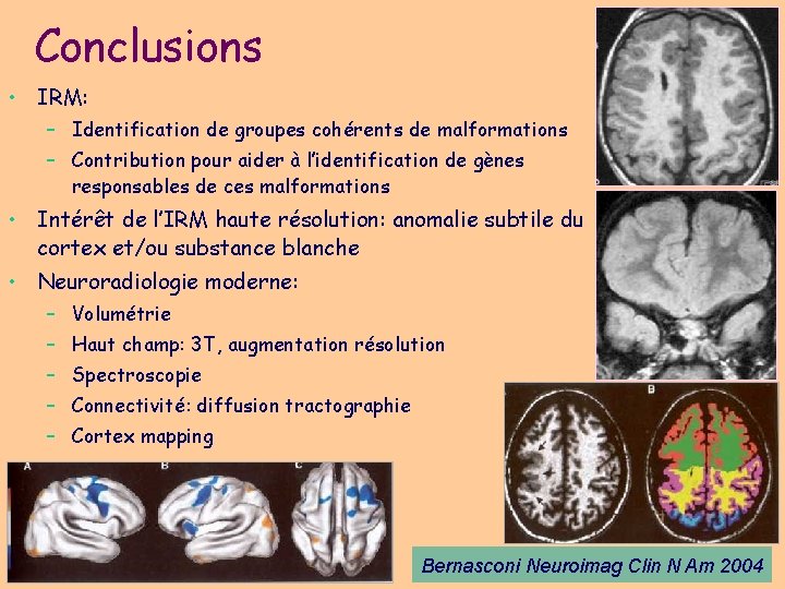 Conclusions • IRM: – Identification de groupes cohérents de malformations – Contribution pour aider