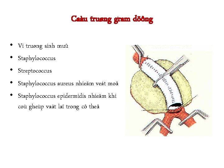 Caàu truøng gram döông • • • Vi truøng sinh muû Staphylococcus Streptococcus Staphylococcus