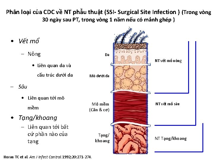 Phân loại của CDC về NT phẫu thuật (SSI- Surgical Site Infection ) (Trong