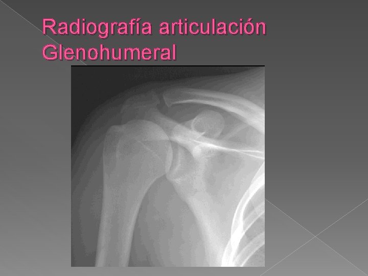 Radiografía articulación Glenohumeral 