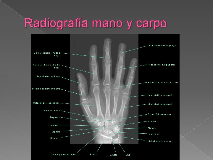 Radiografía mano y carpo 