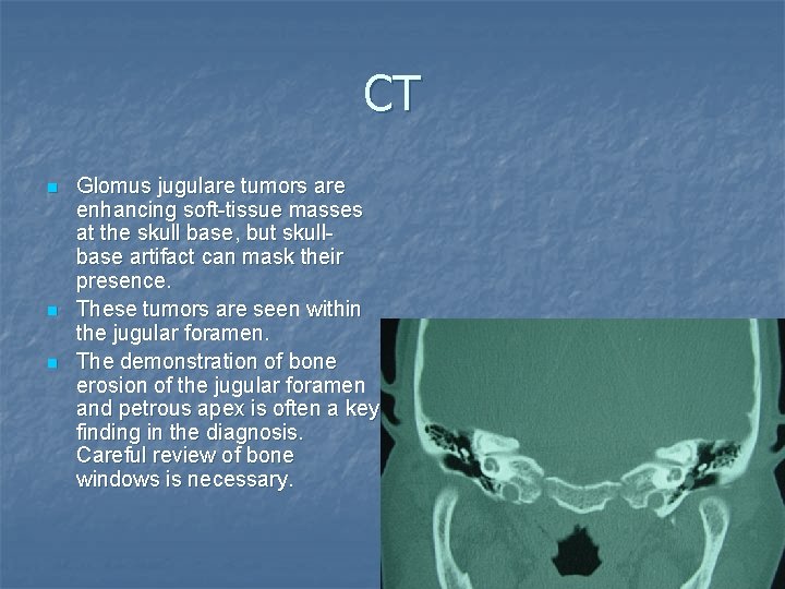 CT n n n Glomus jugulare tumors are enhancing soft-tissue masses at the skull