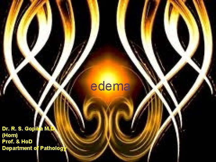 edema Dr. R. S. Gopika M. D. (Hom) Prof. & Ho. D Department of edema Dr. R. S. Gopika M. D. (Hom) Prof. & Ho. D Department of