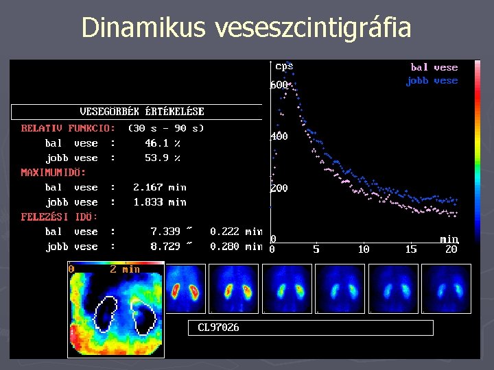 Dinamikus veseszcintigráfia 